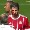 Martinez đổ máu mang chiến thắng về cho Bayern. (Nguồn: BT Sport)