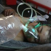 Nạn nhân một vụ tấn công hóa học tại Syria. (Ảnh: AFP)