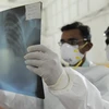Gần 40 người tử vong vì virus cúm A H1N1 ở Ai Cập