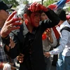 Campuchia buộc tội 5 nghị sỹ CNRP tổ chức biểu tình bạo lực