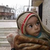 Một em bé bị suy dinh dưỡng nghiêm trọng do cuộc nội chiến ở Madaya, Syria. (Nguồn: theguardian.com)