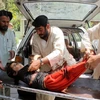 Một em bé Afghanistan bị thương trong vụ nã súng cối ở Kandahar. (Ảnh: AFP/TTXVN)