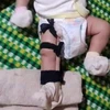 [Video] Tình tiết mới nghi án bé trai 2 tháng bị cha đánh gãy chân