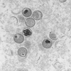 Phát hiện ADN virus đậu mùa khỉ trong tinh dịch của một số bệnh nhân