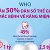 [Infographics] WHO: Gần 50% dân số thế giới mắc bệnh về răng miệng
