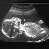 Hình ảnh về thai nhi. (Nguồn: Telegraph)