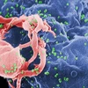 Virus HIV nhìn qua kính hiển vi. (Nguồn: ANSA)