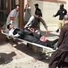 Người bị thương trong vụ đánh bom. (Nguồn: AFP)