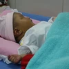 Cháu bé bị gãy chân hiện đang được chăm sóc tại Bệnh viện đa khoa Nhật Tân, thành phố Châu Đốc, tỉnh An Giang. (Ảnh: Công Mạo/TTXVN)