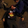 Một người biểu tình trúng đạn hơi cay. (Nguồn: Getty Images)