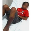 Học sinh Malaysia phải cắt bỏ hai chân do bị người giám sát tôn giáo tra tấn. (Ảnh: The Star)