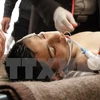 Điều trị cho một trẻ em Syria bị ảnh hưởng bởi cuộc tấn công bị tình nghi sử dụng vũ khí hóa học tại bệnh viện ở Idlib, ngày 4/4. (Nguồn: AFP/TTXVN) 