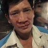 Anh Nguyễn Văn Sinh bị hành hung. (Ảnh Mạnh Khánh/TTXVN)