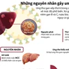 [Infographics] Tìm hiểu những nguyên nhân gây ung thư gan