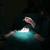 Các bác sỹ bệnh viện đa khoa Đức Giang đang thực hiện ca phẫu thuật lún dương vật ở trẻ nhỏ. (Nguồn: TTXVN)