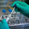 Nghiên cứu viên làm việc trên mẫu bệnh phẩm chứa virus corona chủng mới 2019-nCoV tại phòng thí nghiệm ở Stuttgart, miền Nam Đức ngày 29/1/2020. (Ảnh: AFP/TTXVN)