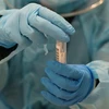 Nhân viên y tế lấy mẫu xét nghiệm COVID-19. (Ảnh: AFP/TTXVN)