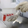 Vabiotech công bố sản xuất thành công lô vaccine COVID-19 Sputnik V đầu tiên tại Việt Nam. (Nguồn: Vabiotech)
