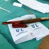 Cành cây đâm vào cổ bệnh nhân N.Q.K, ngụ phường 11, thành phố Vũng Tàu được các bác sỹ Bệnh viện Vũng Tàu phẫu thuật lấy ra từ cổ bệnh nhân. (Ảnh: TTXVN phát)