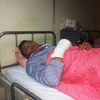 Anh Duy bị chém đứt hai ngón tay hiện đang được điều trị tại bệnh viện Saint Paul (Ảnh: PV/Vietnam+) 