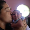 Một em bé bị teo não do nhiễm virus Zika tại Rio de Janeiro, Brazil. (Nguồn: THX/TTXVN)
