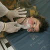 Trẻ em bị nhiễm khí độc trong vụ tấn công tại thị trấn Khan Sheikhoun được điều trị trong một bệnh viện ở Idlib, miền bắc Syria ngày 4/4. (Nguồn: EPA/TTXVN)