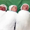 Ba trẻ sinh ba bằng phương pháp tự nhiên khỏe mạnh sau khi sinh. (Ảnh: Tá Chuyên/TTXVN)