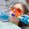 Những điều cần cân nhắc trước khi tẩy trắng răng bằng laser