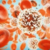 Tế bào ung thư. (Nguồn: medicalnewstoday.com)