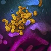 Hình ảnh do Viện nghiên cứu y tế quốc gia cung cấp cho thấy hình ảnh virus SARS-CoV-2 (màu vàng) gây dịch viêm đường hô hấp cấp COVID-19 nổi lên trên bề mặt tế bào (màu xanh, hồng) của một bệnh nhân COVID-19 ở Mỹ. (Ảnh: AFP/TTXVN)