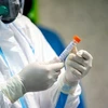Nhân viên y tế kiểm tra bộ kit xét nghiệm virus Corona tại một bệnh viện ở Tehran, Iran. (Ảnh: IRNA/TTXVN)