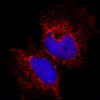 Phát hiện phân tử protein làm thay đổi cấu trúc tế bào ung thư vú