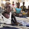 Trẻ em bị suy dinh dưỡng điều trị tại cơ sở y tế ở Aweil, Nam Sudan. (Ảnh: AFP/TTXVN)