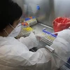 [Video] Phát hiện mới về khả năng tồn tại của virus SARS-CoV-2