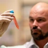 Các nhà khoa học Australia phát triển hydrogel điều trị bệnh Parkinson