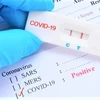 Rà soát việc dân tự phát hiện mắc COVID-19 nhưng không thông báo