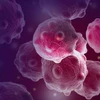 Sanofi ngừng phát triển chất amcenestrant điều trị ung thư vú