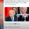[Video] Vết đen bí ẩn trên trán Tổng thống Mỹ Joe Biden gây bão mạng