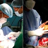 Sri Lanka: Phẫu thuật loại bỏ viên sỏi thận lớn nhất thế giới 