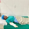 Bệnh nhân Lù A Chơ (sinh năm 1972) bị bỏng độ 1, đang điều trị tại Bệnh viện Đa khoa khu vực Nghĩa Lộ. (Ảnh: TTXVN phát)