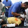 Em nhỏ bị thương do xung đột Hamas-Israel được điều trị tại bệnh viện ở Rafah, Dải Gaza, ngày 15/5. (Ảnh: THX/TTXVN)
