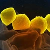 Vi khuẩn Liên cầu khuẩn nhóm A. (Ảnh: Getty)