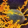 Kính hiển vi điện tử cho thấy hình ảnh của SARS-CoV-2 (vật thể tròn màu vàng), gây bệnh COVID-19, đang xuất hiện từ các tế bào nuôi cấy. (Ảnh: The Epoch Times)