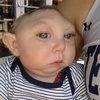 Khi sinh ra Jaxon Emmett Buell bị thiếu mất phần lớn não bộ và hộp sọ. (Nguồn: Daily Mail)