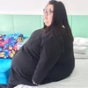 Người phụ nữ béo nhất Trung Quốc phẫu thuật dạ dày để giảm cân. (Nguồn: CCTVNews)