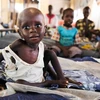 Trẻ em Sudan bị suy dinh dưỡng điều trị tại một bệnh viện ở Aweil. (Nguồn: AFP/TTXVN) 