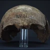 Xương của người đàn ông thời kỳ săn bắn hái lượm 5.000 năm trước. (Ảnh: Đại học Kiel)