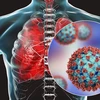 Virus SARS-CoV-2 tấn công khiến phổi bị suy giảm chức năng hô hấp. (Ảnh: Science Photo) 