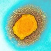 Hình ảnh virus đậu mùa khỉ dưới kính hiển vi điện tử. (Ảnh: Cơ quan an ninh y tế Anh/TTXVN) 
