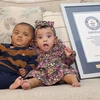 Hai em bé sinh non nhất thế giới chào đón sinh nhật đầu tiên
